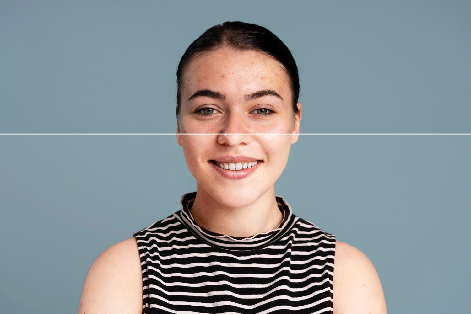 Pigmentation Removal